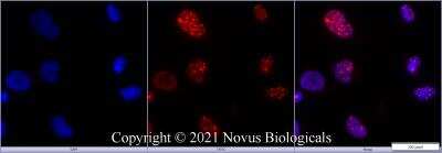 Imaging of HeLa Cells Stained for 53BP1 Using Conjugated 53BP1 Antibody